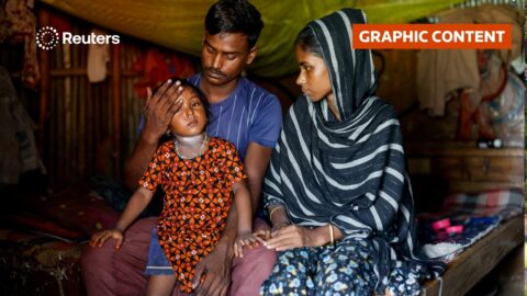 Brote de sarampión en Bangladesh deja más de 1.100 muertos
