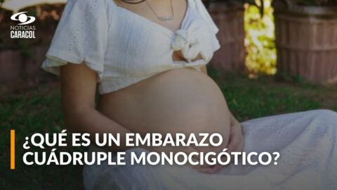 Cómo se forma un embarazo cuádruple idéntico y sus riesgos