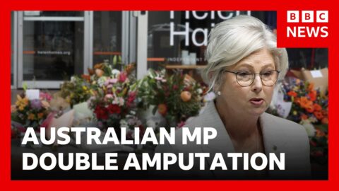 Diputada australiana pierde ambas piernas tras presunto ataque con auto