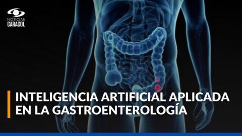 IA mejora la precisión en diagnósticos de gastroenterología