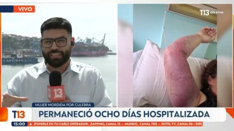 Mordida de culebra en Putaendo deja a una mujer afectada