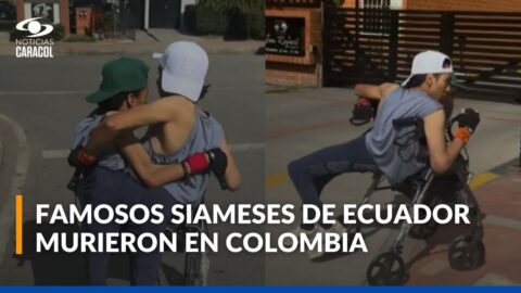 Mueren en Colombia los siameses ecuatorianos Cevallos Herrera