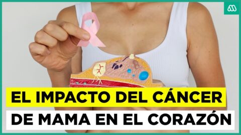 Radioterapia y salud cardíaca: controles y nutrición para envejecer mejor