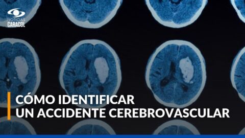 Síntomas del derrame cerebral y qué hacer ante una emergencia